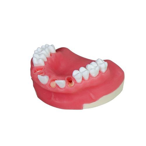 Mandible model - JG-Y8-F2 - FOSHAN JINGLE MEDICAL EQUIPMENT CO., LTD - teeth / gingival / surgical