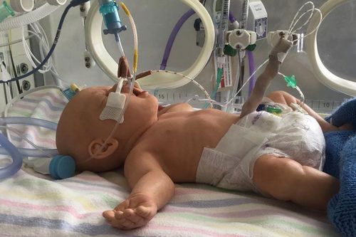 Baby patient simulator - DDH - LifeCast Body Simulation Ltd - airway management / CPR / for pediatric care