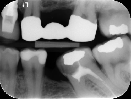 Caries detection software - ORCA DENTAL AI - image analysis / diagnostic / clinical