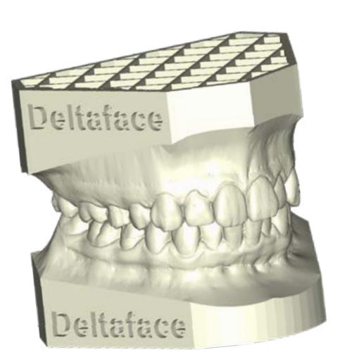 Dental prosthesis design software - ARCH BASE - Coruo - 3D printing / for archiving / modeling