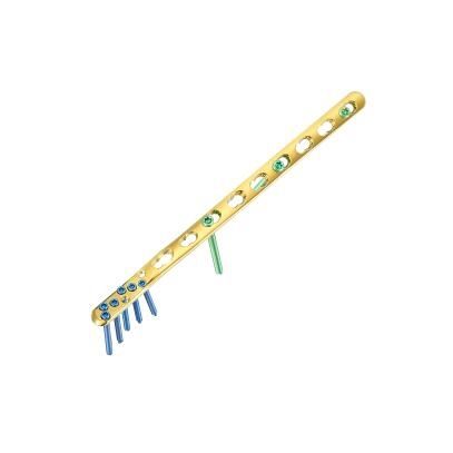 Fibula compression plate - Wuhan Yijiabao Biological Materials - distal / metallic