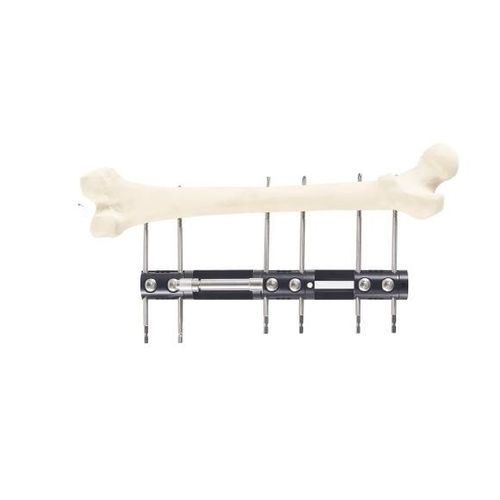 Tibia external fixation system - Wuhan Yijiabao Biological Materials - radius / tubular / adult