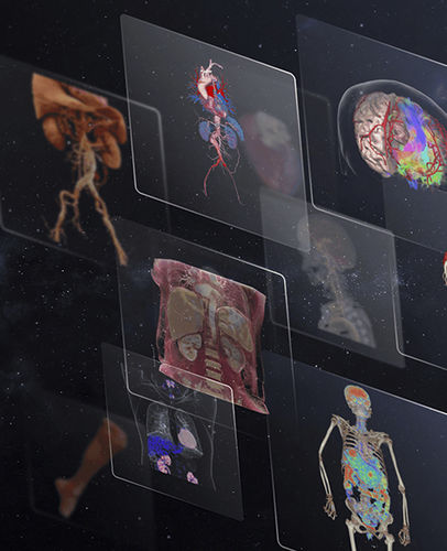 Medical software - uOmnispace - Shanghai United Imaging - surgical / cardiology / CT