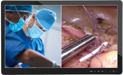 Medical monitor - MBT-1000-43.1(2) - EMBITRON - operating room / endoscopy / dental