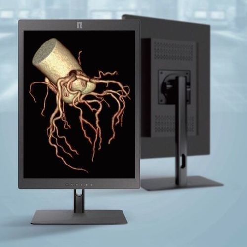 Medical imaging display - Shenzhen Kenid Medical Devices - vital sign / high-definition