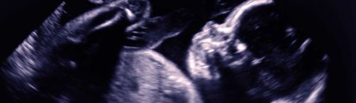 Analysis software - Congenica Prenatal™ - Congenica Ltd - diagnostic / medical / clinical