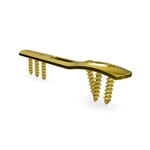 Malleolus compression plate - Malleolus 3.5 locking compression plate - Astrolabe - distal / lateral / locking
