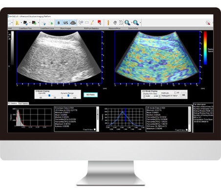 Ultrasound imaging software - AmCAD-US - AmCad BioMed - visualization / diagnostic / interpretation