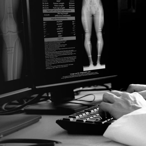 Measurement software - LAMA™ - Imagebiopsy Lab - image analysis / reporting / calibration