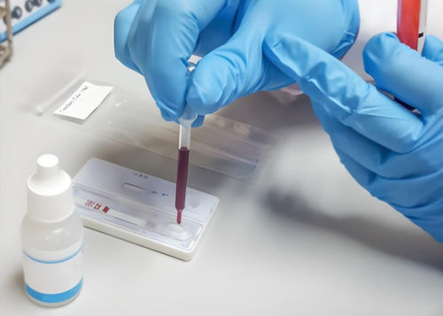 Infectious disease test kit - 6109 - MEDIPAN GmbH - influenza A / influenza B / clinical