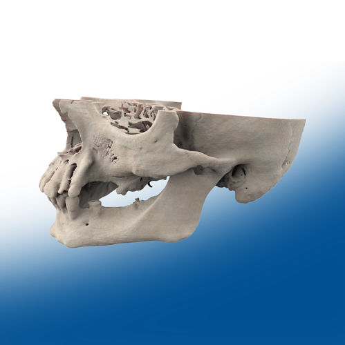 Mandible model - Ortho Baltic - surgical / training