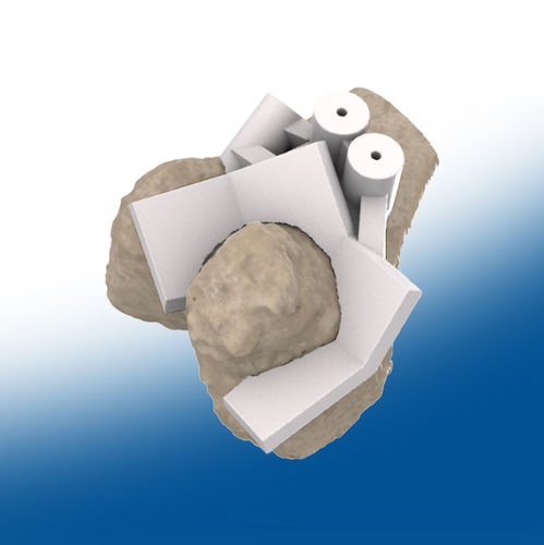 Hip prosthesis resection guide - 3D - Ortho Baltic