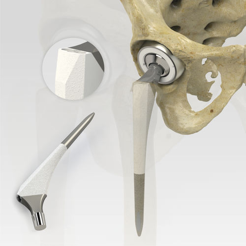 Primary hip prosthesis - 7022-4 series - Zimed Medical - cementless