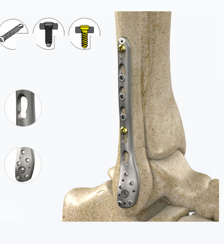 Fibula compression plate - 1842 series - Zimed Medical - distal / lateral / locking
