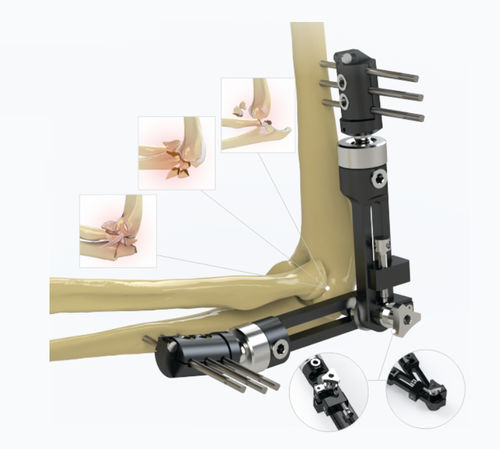Elbow external fixation system - 5934-0000 - Zimed Medical - tubular / adult