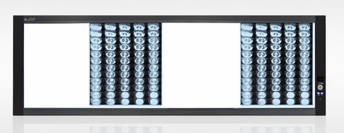 Digital X-ray film viewer - ZG-4B - Hunan Mplent Optoelectronics Technology - 4-screen / with switch / LED