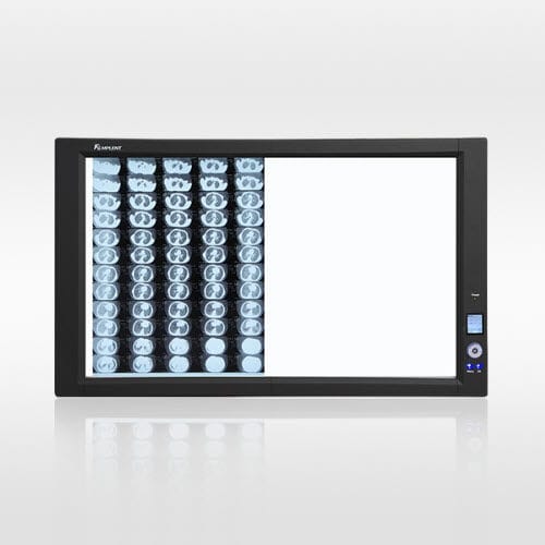 Digital Xray film viewer ZG2 Hunan Mplent Optoelectronics