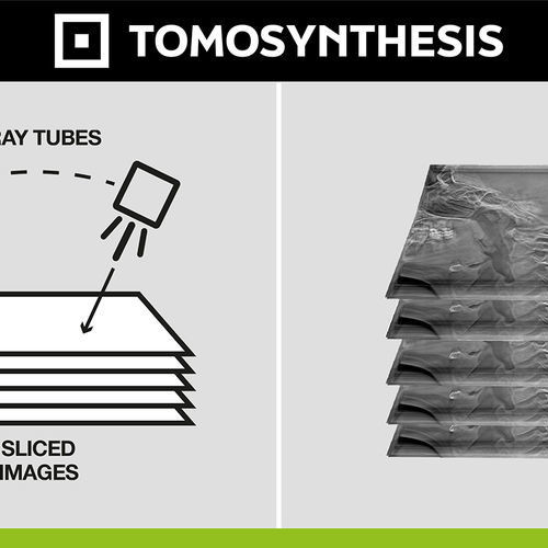 Diagnostic software - Digital Tomosynthesis - Digitec - post-processing / capture / medical