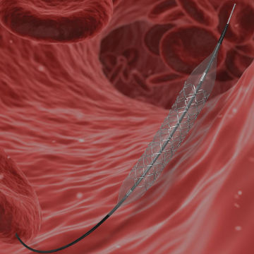Coronary stent - TwinRap - SLTL Medical - polymer / stainless steel / drug eluting
