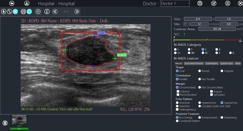 Image analysis software - BU-CAD™ - TaiHao Medical - reporting / diagnostic / interpretation