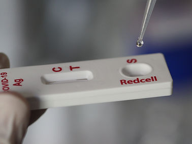 COVID-19 rapid diagnostic test - RCCOVST   - Redcell Biotechnology - for antibodies / SARS-COV-2 / nasal
