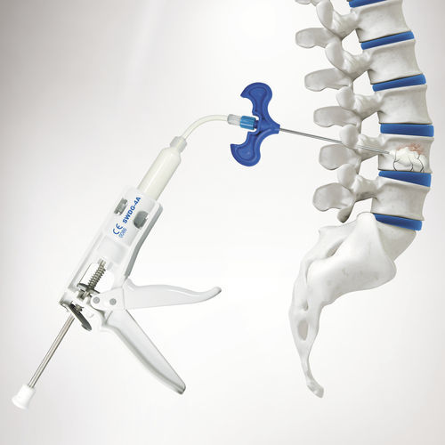 Bone cement injection instrument kit - SPASY BCD ™  - Seawon Meditech