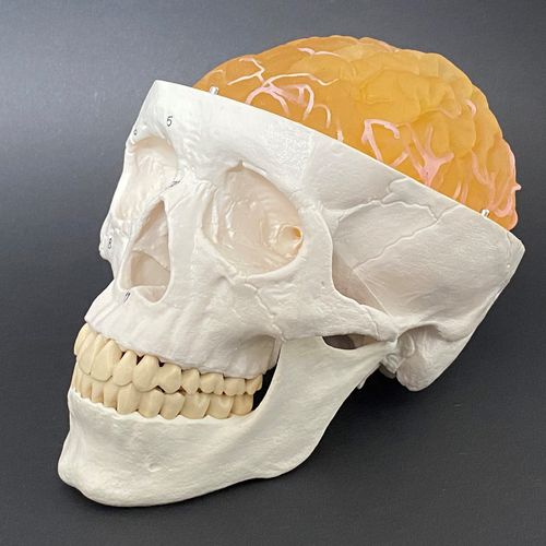 Tumor anatomical model - Schiner3DRepro - brain / neurosurgery / training