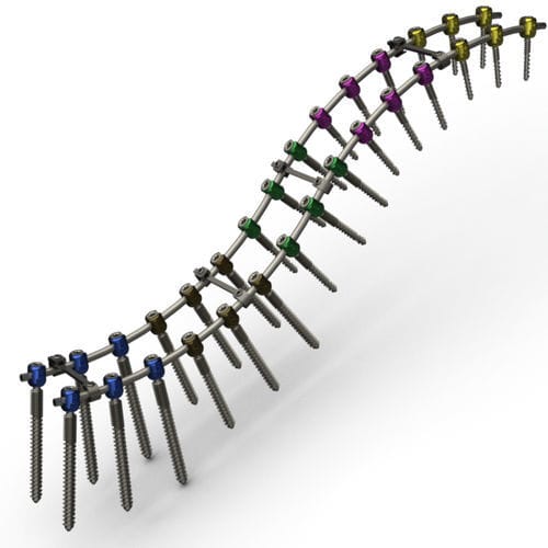 Thoraco-lumbo-sacral osteosynthesis unit - RPT series - TASARIMMED - posterior / adult