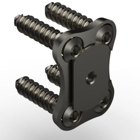 Cervical arthrodesis plate - LPCS2 - TASARIMMED - locking / metallic / 1 level