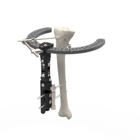 Tarsal joint external fixation system - MAF - TASARIMMED - metacarpophalangeal joint / hybrid / adult
