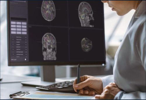 Analysis software - VUNO Med®-DeepBrain® - VUNO - diagnostic / for MRI / neurological