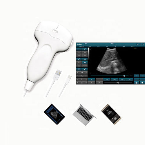 Hand-held ultrasound system - HS-UP20 - Healson Technology - for gynecological and obstetric ultrasound imaging / for abdominal and pelvic ultrasound imaging / for breast ultrasound imaging