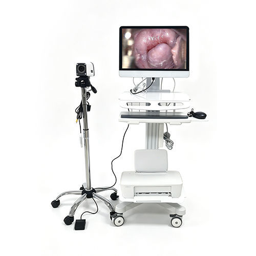 Video colposcope - EK-6000E - Jiangsu Yikang Electronic Technology - digital / trolley-mounted
