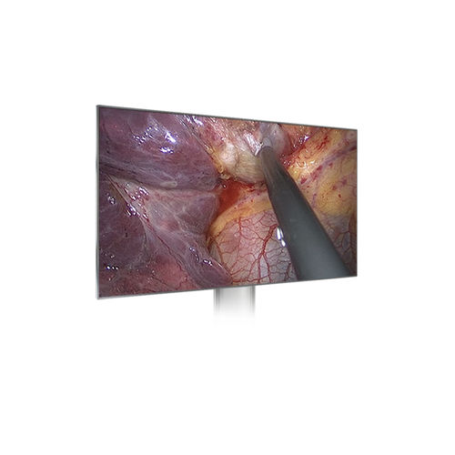 Medical monitor - HD1910 - Xuzhou Hengjia Electronic Technology - endoscopy / surgical / 1920 x 1080