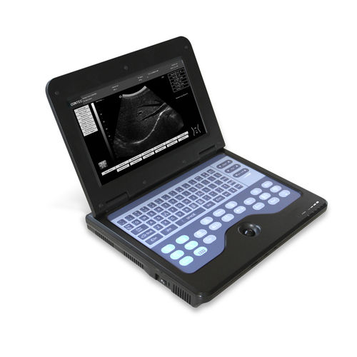 portable ultrasound system - Contec Medical Systems