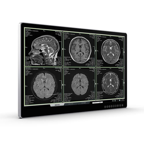 Medical imaging display - UHD Surgical Monitor - Vecoton Technology - surgical / 4K UHD / anti-glare