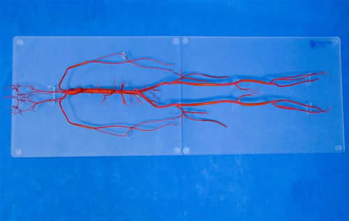Whole body vascular model - SDL008 - Trando 3D Medical Technology - vascular surgery / training / flexible