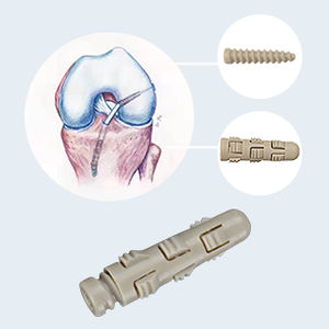 Anterior cruciate ligament interference screw - PSS-1 - Star Sports Medicine - non-absorbable