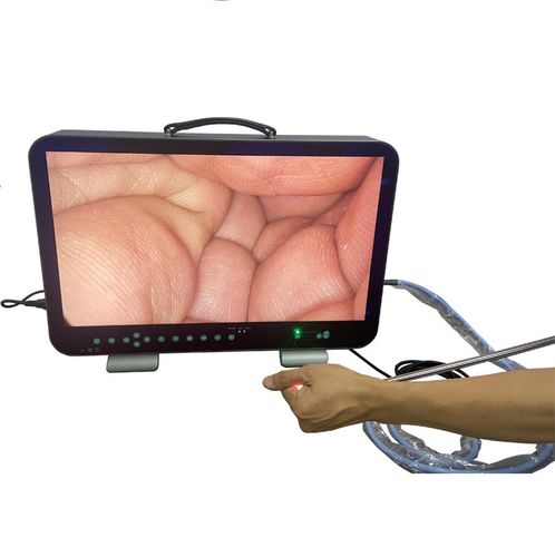 Endoscope camera - E33 - Shantou Easywell Electronic Technologies - medical / surgical / digital