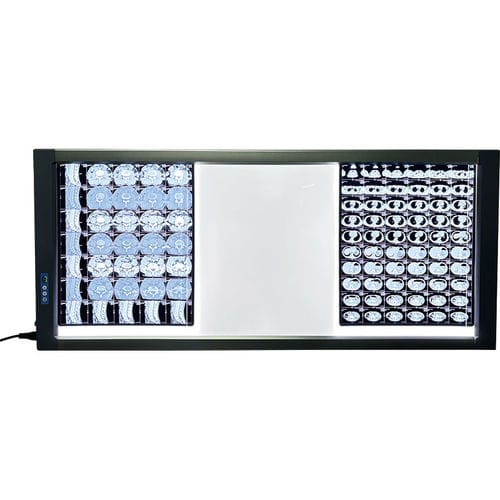 Digital X-ray film viewer - MST-4000III - Shantou Easywell Electronic Technologies - 3-screen / LED