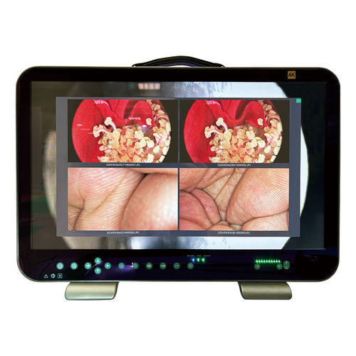 Endoscope video camera - E43 - Shantou Easywell Electronic Technologies - dental / veterinary / monitoring