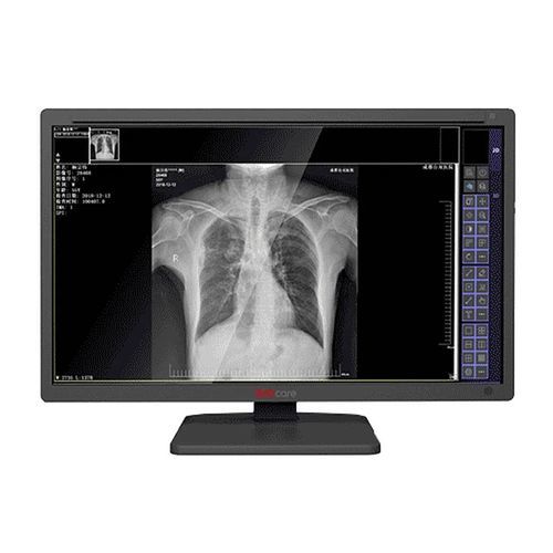 Medical display - MDS-C series - Shenzhen Juding Medical Equipment Co.,Ltd. - diagnostic / medical imaging / radiology