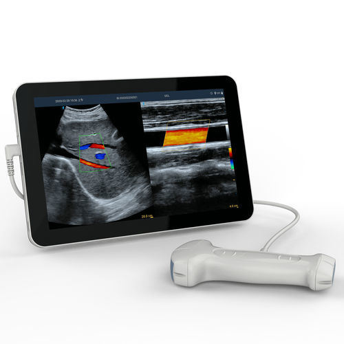 hand-held ultrasound system - Beijing iTrason Technologies