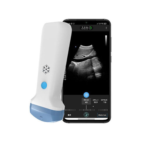 Hand-held ultrasound system - S35C - Beijing iTrason Technologies - for gynecological and obstetric ultrasound imaging / for abdominal and pelvic ultrasound imaging / for emergency medicine ultrasound imaging