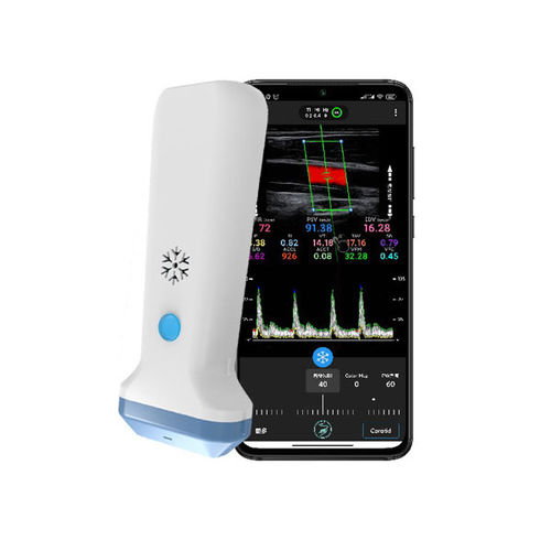 Hand-held ultrasound system - S35L - Beijing iTrason Technologies - for emergency medicine ultrasound imaging / for breast ultrasound imaging / for musculoskeletal ultrasound imaging