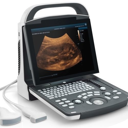 Portable ultrasound system - DP10 - Beijing iTrason Technologies - for multipurpose ultrasound imaging / for gynecological and obstetric ultrasound imaging / for abdominal and pelvic ultrasound imaging
