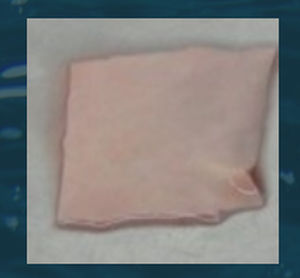 Cardiac tissue matrix - CenoBiologics - allograft
