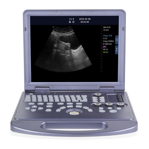 B/W Ultrasound System - DW-360 - Jiangsu Dawei Medical - Portable / For ...