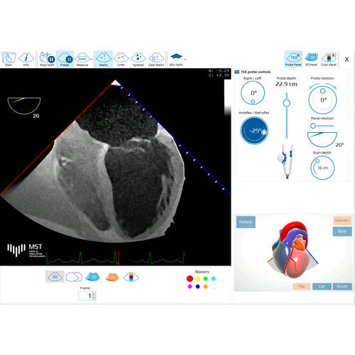 Test software - eTEEmothy - Medical Simulation Technologies - training / for medical simulation / medical