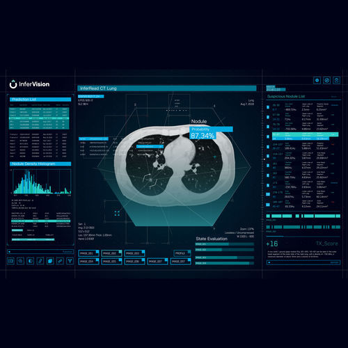 Analysis software - Beijing Infervision Technology Co. Ltd. - reporting / treatment / validation
